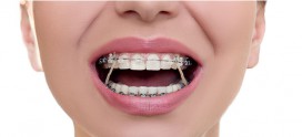 ارتودنسی دندان با بهترین نتایج در کرج