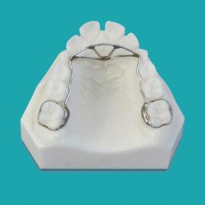 دستگاه برطرف کردن عادت – مهار کننده زبان (Tongue Thrust Appliance) Bands on the 1st permanent molars .036 wire is bent from the 1st molar to the cingulum of the cuspids