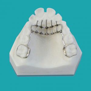 دستگاه برطرف کردن عادت – جلوگیری از مکیدن انگشت (Thumb Habit Appliance) Bands on the 1st permanent molars .036 wire is bent from the 1st molar to the cingulum of the cuspids