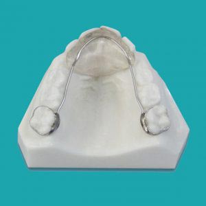 دستگاه برطرف کردن عادت – بایت پلیت ثابت (Fixed Bite Plate) Bands on the 1st permanent molars .036 wire contoured to the lingual of the anterior teeth Acrylic bite plate added cuspid to cuspid