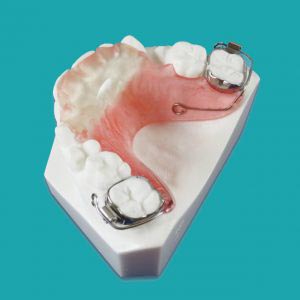 بایت پلیت قدامی (Anterior Bite Plate) Buccal Tube Clasp clasps on the molars