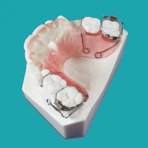 بایت پلیت قدامی (Anterior Bite Plate) Buccal Tube Clasp clasps on the 2nd molars Ball Clasps between the 2nd bi-cuspid and the 1st molar