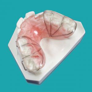بایت پلیت خلفی (Posterior Bite Plate) Adams Clasp on the 1st molars and the 1st bi-cuspid or 1st primary molar