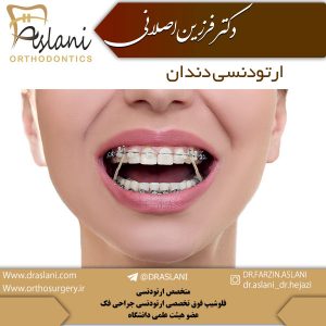 ارتودنسی دندان - دکتر اصلانی