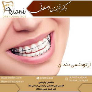 ارتودنسی دندان - دکتر اصلانی