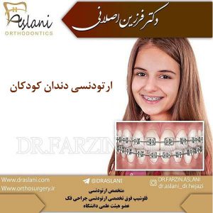 ارتودنسی دندان کودکان - دکتر اصلانی