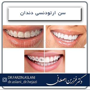 سن ارتودنسی دندان