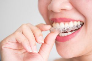 پوسیدگی دندان در درمان ارتودنسی - دکتر اصلانی